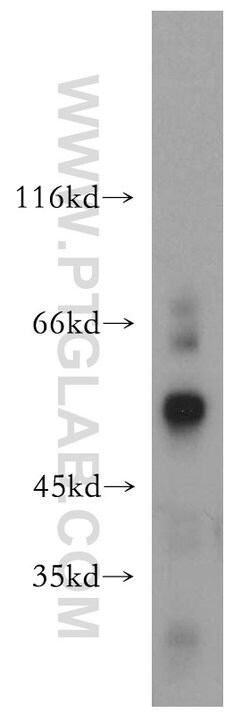 SIAH1 Rabbit anti-Human, Mouse, Polyclonal, Proteintech:Antibodies:Primary