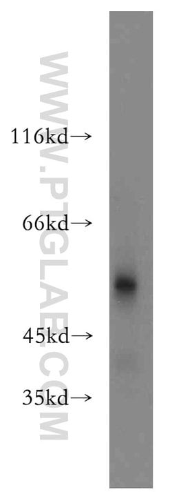 SIAH1 Rabbit anti-Human, Mouse, Polyclonal, Proteintech:Antibodies:Primary