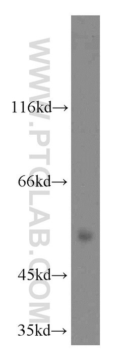 SIAH1 Rabbit anti-Human, Mouse, Polyclonal, Proteintech:Antibodies:Primary