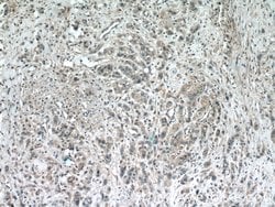 Proteintech STARD8 Rabbit anti-Human, Polyclonal, Proteintech