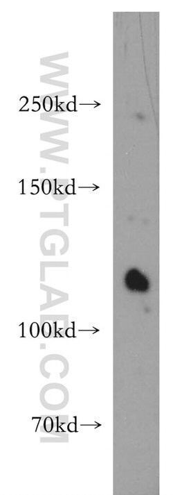 STARD8 Rabbit anti-Human, Polyclonal, Proteintech:Antikörper:Primärantikörper