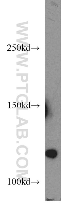 STARD8 Rabbit anti-Human, Polyclonal, Proteintech:Antikörper:Primärantikörper