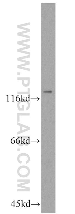 ZHX1 Rabbit anti-Human, Mouse, Rat, Polyclonal, Proteintech 150 &mu;L;