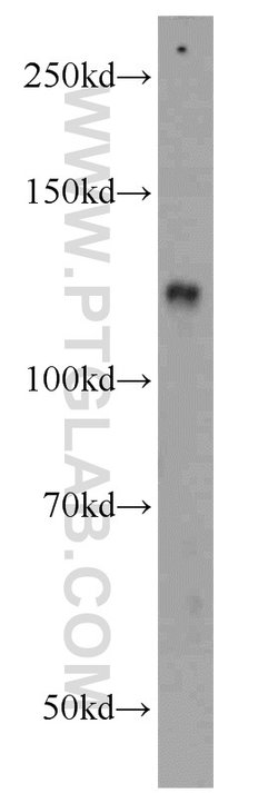 ZHX1 Rabbit anti-Human, Mouse, Rat, Polyclonal, Proteintech 150 &mu;L;