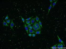 KLHDC3 Rabbit anti-Human, Mouse, Rat, Polyclonal, Proteintech 150 μL;