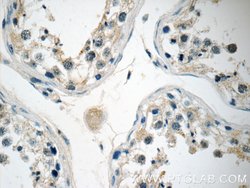 KLHDC3 Rabbit anti-Human, Mouse, Rat, Polyclonal, Proteintech 150 μL;
