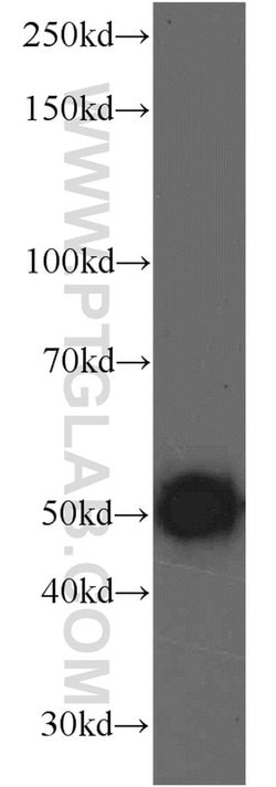 KLHDC3 Rabbit anti-Human, Mouse, Rat, Polyclonal, Proteintech 150 μL;