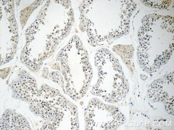 KLHDC3 Rabbit anti-Human, Mouse, Rat, Polyclonal, Proteintech 150 μL;
