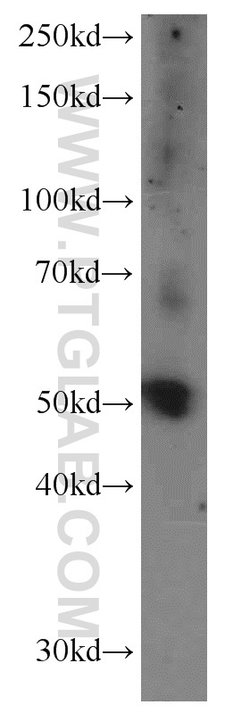 KLHDC3 Rabbit anti-Human, Mouse, Rat, Polyclonal, Proteintech 150 μL;