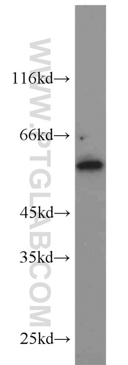 KLHDC3 Rabbit anti-Human, Mouse, Rat, Polyclonal, Proteintech 150 μL;