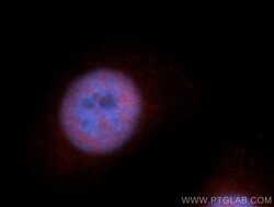 RBM17 Rabbit anti-Human, Mouse, Rat, Polyclonal, Proteintech 150 &mu;L;