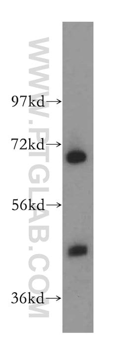 RBM17 Rabbit anti-Human, Mouse, Rat, Polyclonal, Proteintech 150 &mu;L;