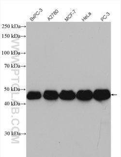 RBM17 Rabbit anti-Human, Mouse, Rat, Polyclonal, Proteintech 150 &mu;L;