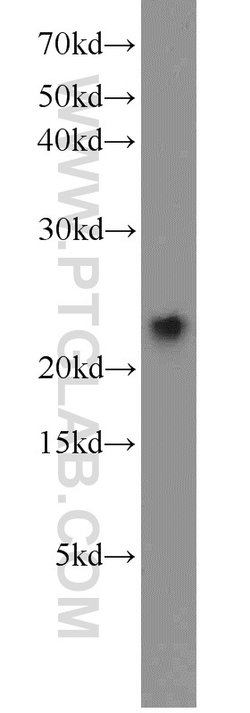 VILIP-1 Rabbit anti-Human, Mouse, Rat, Polyclonal, Proteintech 150 &mu;L;