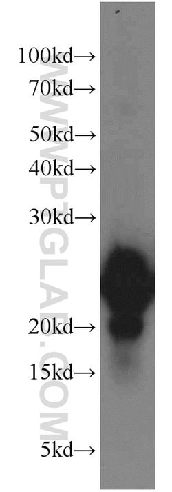 VILIP-1 Rabbit anti-Human, Mouse, Rat, Polyclonal, Proteintech 150 &mu;L;