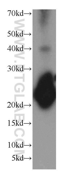 VILIP-1 Rabbit anti-Human, Mouse, Rat, Polyclonal, Proteintech 150 &mu;L;