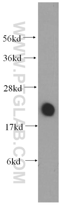 VILIP-1 Rabbit anti-Human, Mouse, Rat, Polyclonal, Proteintech 150 &mu;L;