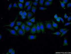 VILIP-1 Rabbit anti-Human, Mouse, Rat, Polyclonal, Proteintech 150 &mu;L;