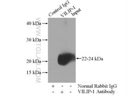 VILIP-1 Rabbit anti-Human, Mouse, Rat, Polyclonal, Proteintech 150 &mu;L;