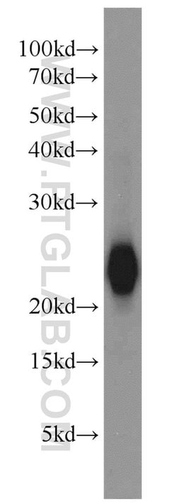 VILIP-1 Rabbit anti-Human, Mouse, Rat, Polyclonal, Proteintech 150 &mu;L;