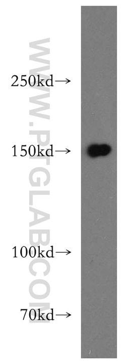 DHX29 Rabbit anti-Human, Mouse, Rat, Polyclonal, Proteintech:Antibodies:Primary