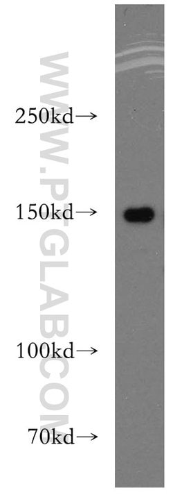 DHX29 Rabbit anti-Human, Mouse, Rat, Polyclonal, Proteintech:Antibodies:Primary