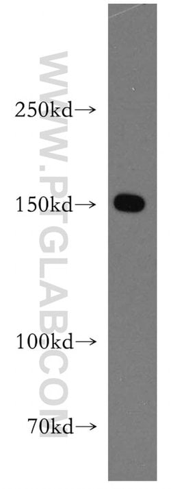 DHX29 Rabbit anti-Human, Mouse, Rat, Polyclonal, Proteintech:Antibodies:Primary