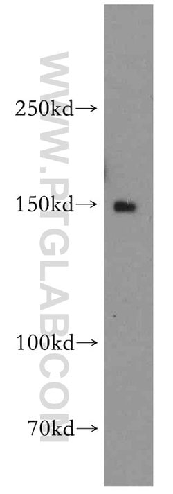 DHX29 Rabbit anti-Human, Mouse, Rat, Polyclonal, Proteintech:Antibodies:Primary