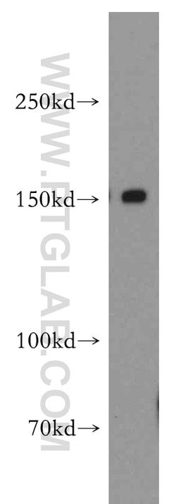 DHX29 Rabbit anti-Human, Mouse, Rat, Polyclonal, Proteintech:Antibodies:Primary