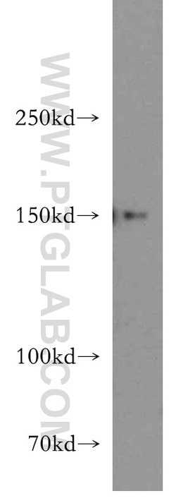 DHX29 Rabbit anti-Human, Mouse, Rat, Polyclonal, Proteintech:Antibodies:Primary