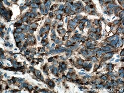 CA4 Rabbit anti-Human, Mouse, Rat, Polyclonal, Proteintech 150 &mu;L; Unconjugated:Antibodies,