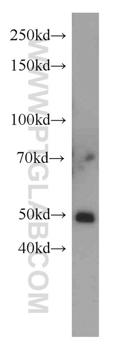 TSPYL1 Rabbit anti-Human, Mouse, Polyclonal, Proteintech:Antibodies:Primary