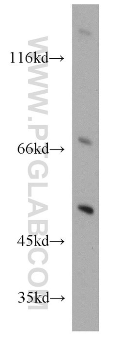 TSPYL1 Rabbit anti-Human, Mouse, Polyclonal, Proteintech:Antibodies:Primary