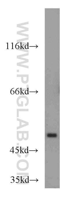 TSPYL1 Rabbit anti-Human, Mouse, Polyclonal, Proteintech:Antibodies:Primary