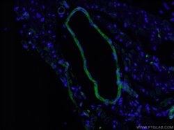 Calponin Rabbit anti-Human, Mouse, Rat, Polyclonal, Proteintech:Antibodies:Primary