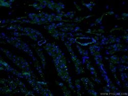 Calponin Rabbit anti-Human, Mouse, Rat, Polyclonal, Proteintech:Antibodies:Primary