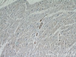 Calponin Rabbit anti-Human, Mouse, Rat, Polyclonal, Proteintech:Antibodies:Primary