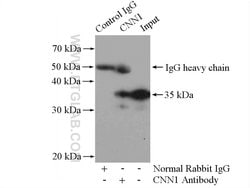 Calponin Rabbit anti-Human, Mouse, Rat, Polyclonal, Proteintech:Antibodies:Primary