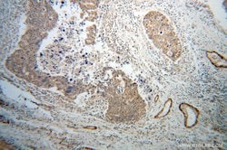 Calponin Rabbit anti-Human, Mouse, Rat, Polyclonal, Proteintech:Antibodies:Primary