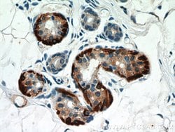 Calponin Rabbit anti-Human, Mouse, Rat, Polyclonal, Proteintech:Antibodies:Primary