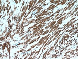Calponin Rabbit anti-Human, Mouse, Rat, Polyclonal, Proteintech:Antibodies:Primary