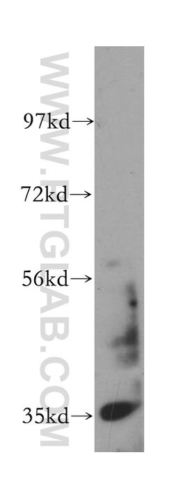 Calponin Rabbit anti-Human, Mouse, Rat, Polyclonal, Proteintech:Antibodies:Primary