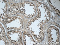 EMB Rabbit anti-Human, Mouse, Polyclonal, Proteintech 150 &mu;L; Unconjugated:Antibodies,