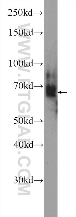 EMB Rabbit anti-Human, Mouse, Polyclonal, Proteintech 150 &mu;L; Unconjugated:Antibodies,