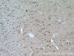 FAM19A5 Rabbit anti-Human, Mouse, Rat, Polyclonal, Proteintech 150 &mu;L;