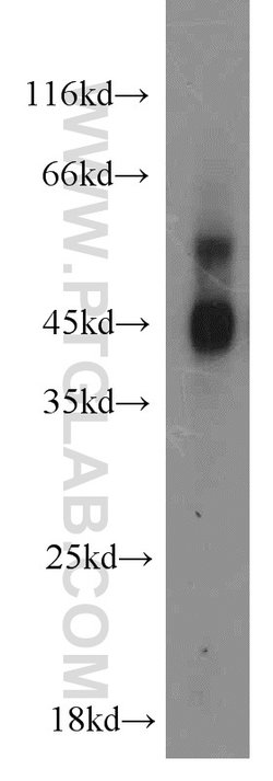 MAPKAPK2 Rabbit anti-Human, Mouse, Polyclonal, Proteintech:Antibodies:Primary