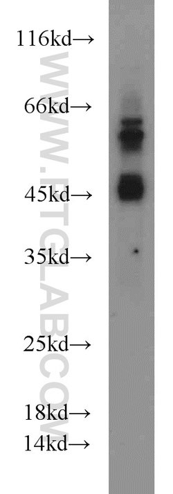 MAPKAPK2 Rabbit anti-Human, Mouse, Polyclonal, Proteintech:Antibodies:Primary