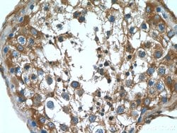 ALDH1A2 Rabbit anti-Human, Mouse, Rat, Polyclonal, Proteintech 150 &mu;L;