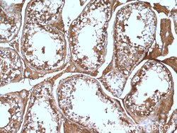 ALDH1A2 Rabbit anti-Human, Mouse, Rat, Polyclonal, Proteintech 150 &mu;L;