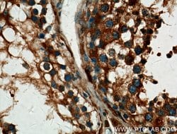 ALDH1A2 Rabbit anti-Human, Mouse, Rat, Polyclonal, Proteintech 150 &mu;L;